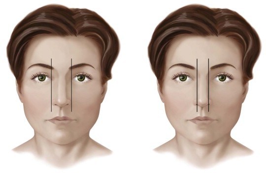 Rhinomodulation Comprehensive Guide